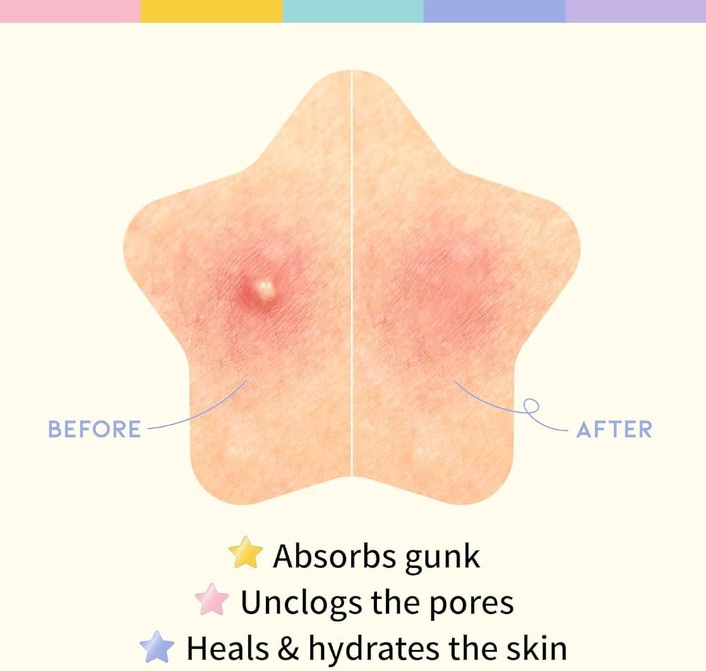 Star Spot Patch de OOTD