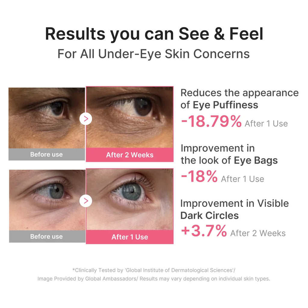 PDRN Pink Caffeine Collagen Eye Patch de Medicube