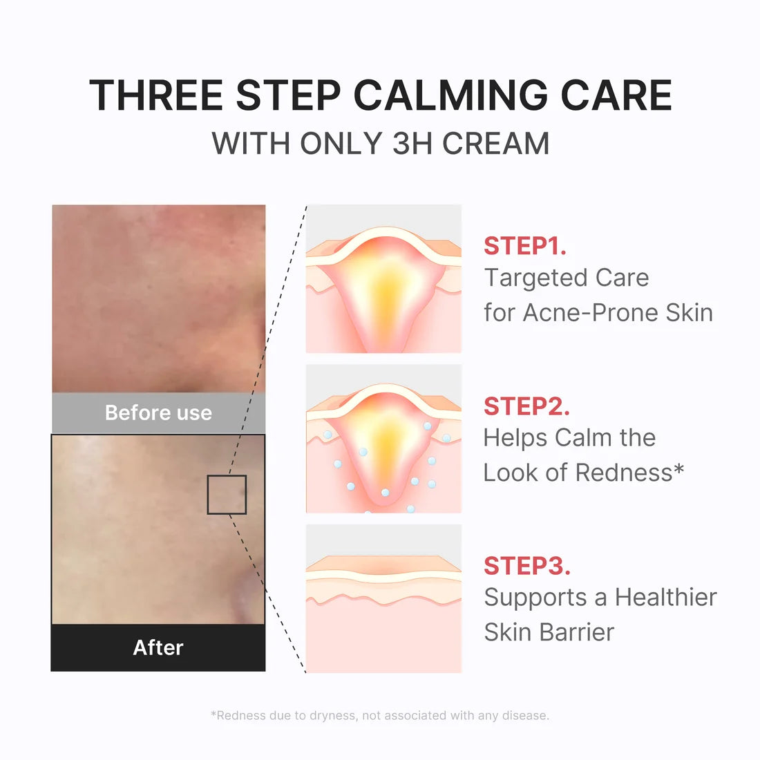 3H Relief Cream de Medicube