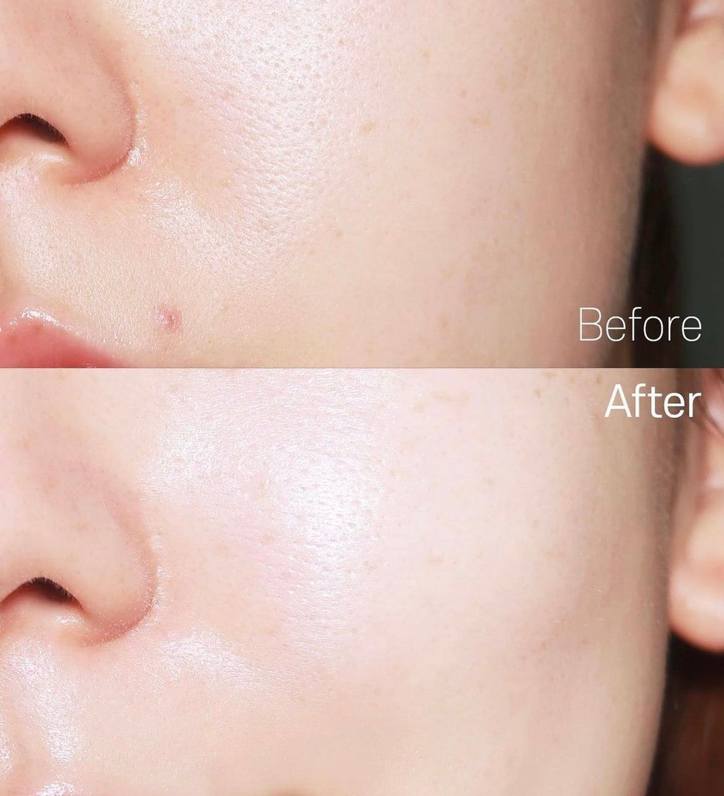 Ampolla Tone Brightening Capsule de Skin1004