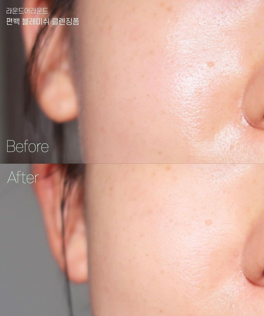 Ampolla Poremizing Fresh de Skin1004
