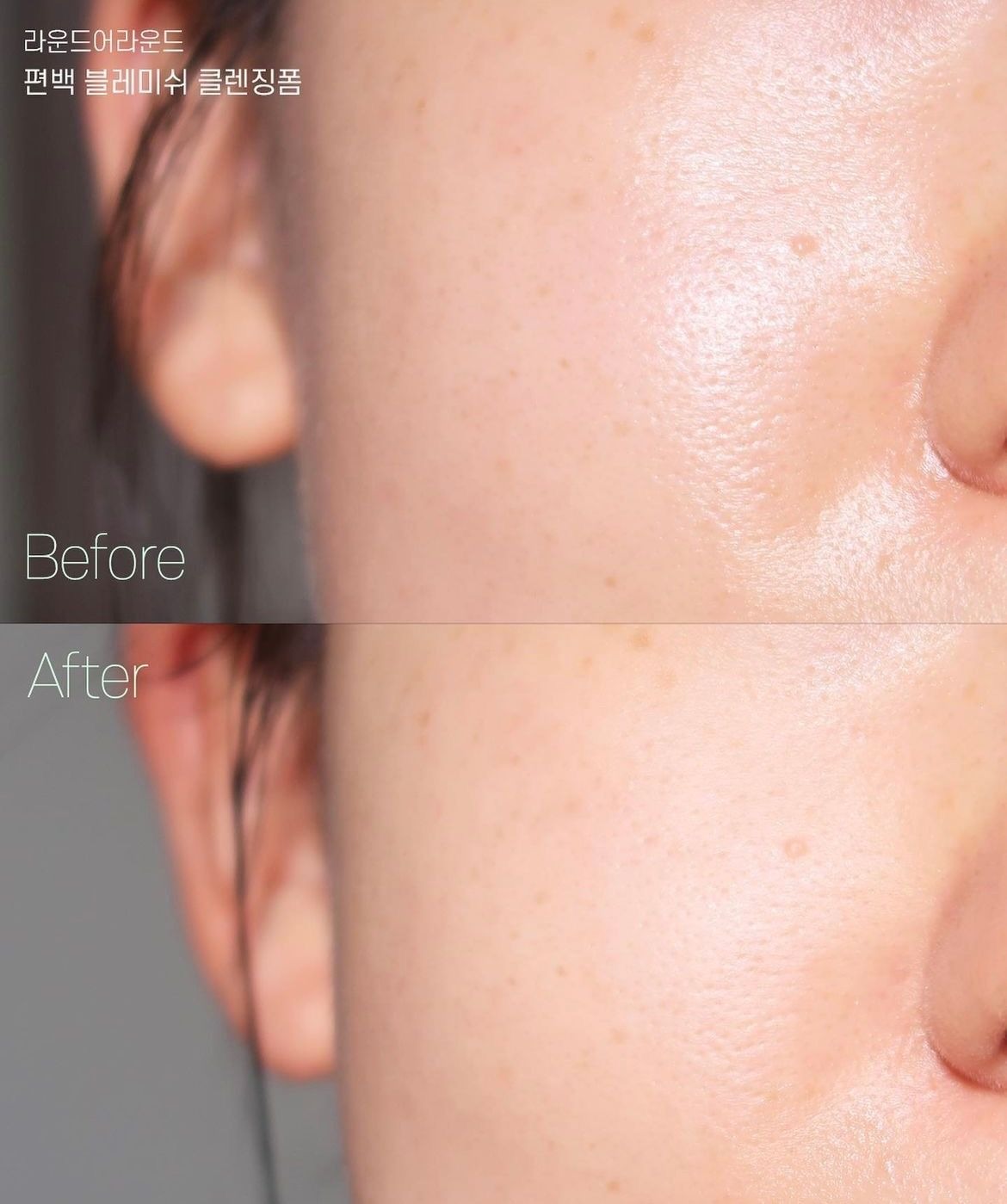 Ampolla Poremizing Fresh de Skin1004