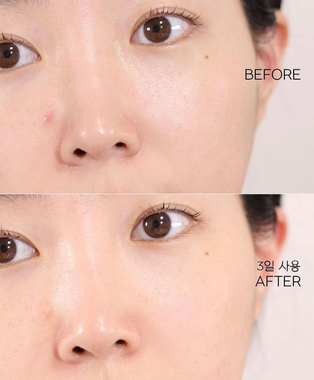 Tónico exfoliante Poremizing Clear Toner de Skin1004