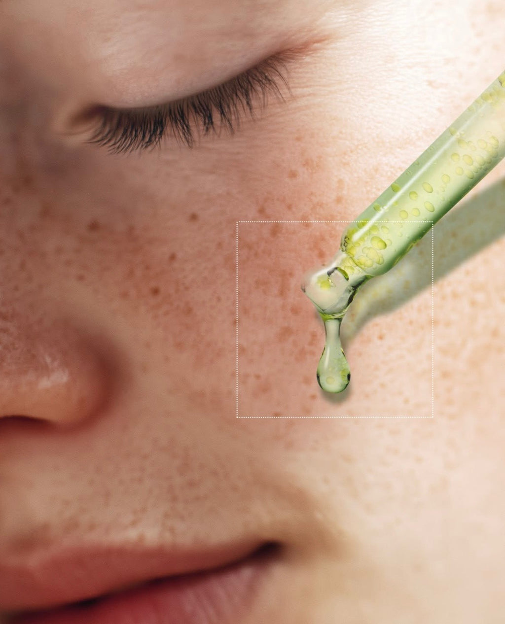 Azelaic Acid 10 Kojic Tea Tree Serum de Purito