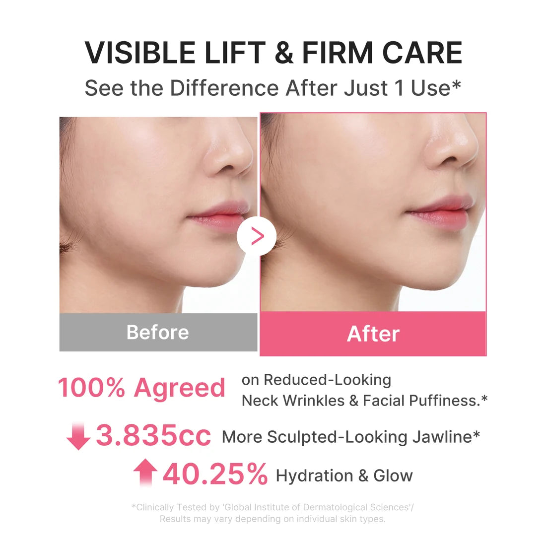PDRN Collagen Gua Sha Neck Wrinkle Cream de Medicube