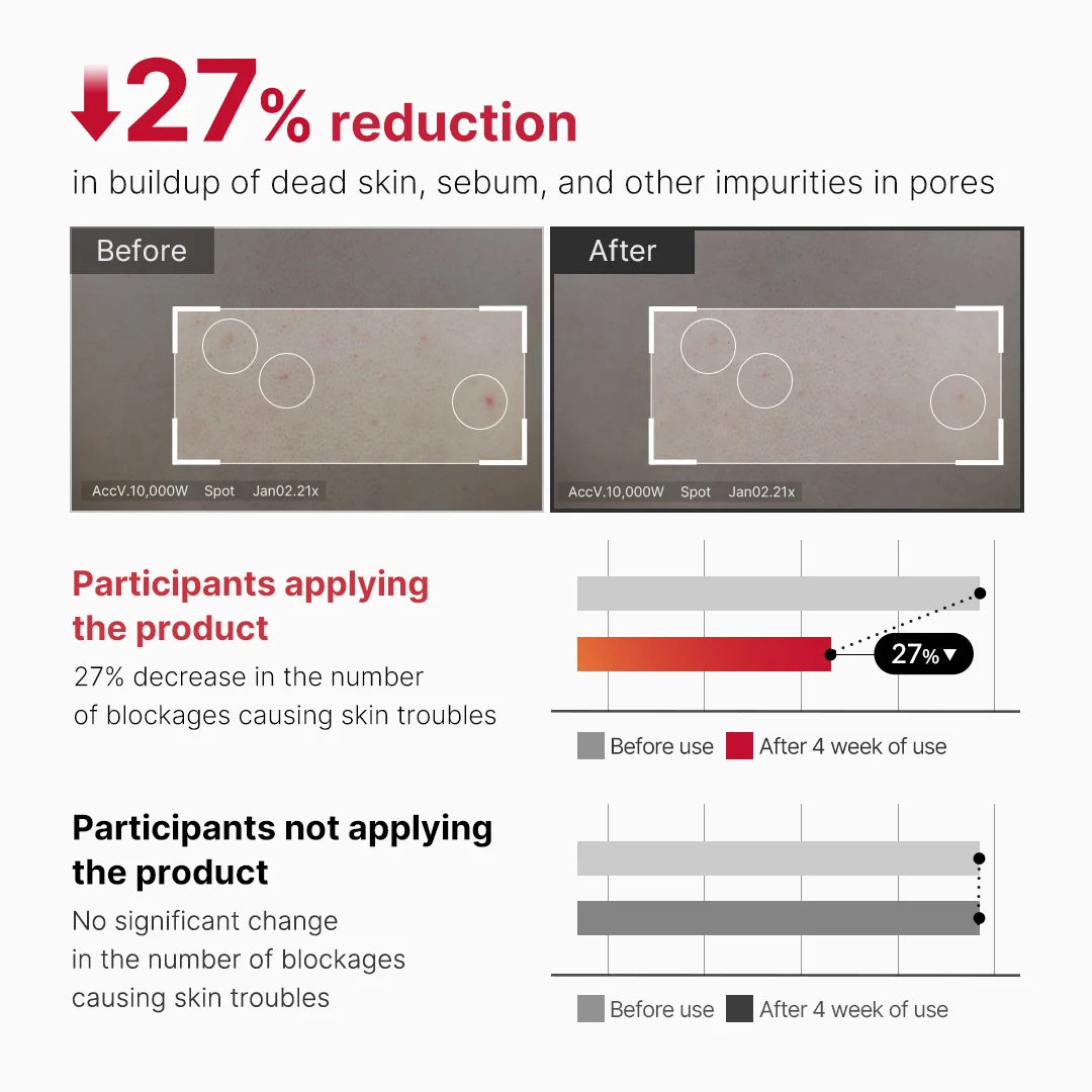 Peeling corporal: Red Acne Body Peeling Shot de Medicube