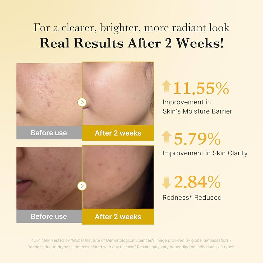 Kojic Acid Turmeric Niacinamide Capsule Serum de Medicube