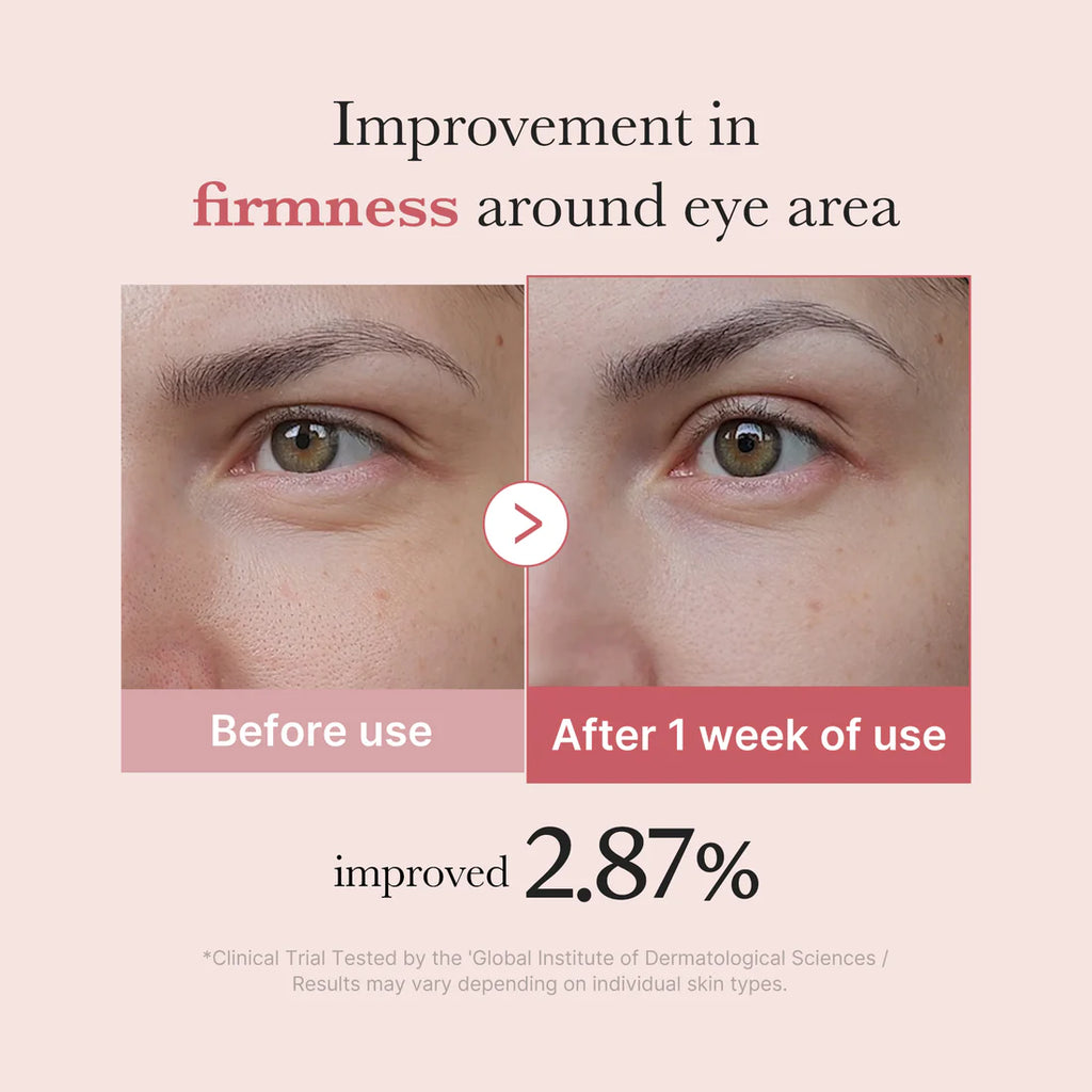 PDRN Pink Peptide Eye Cream de Medicube
