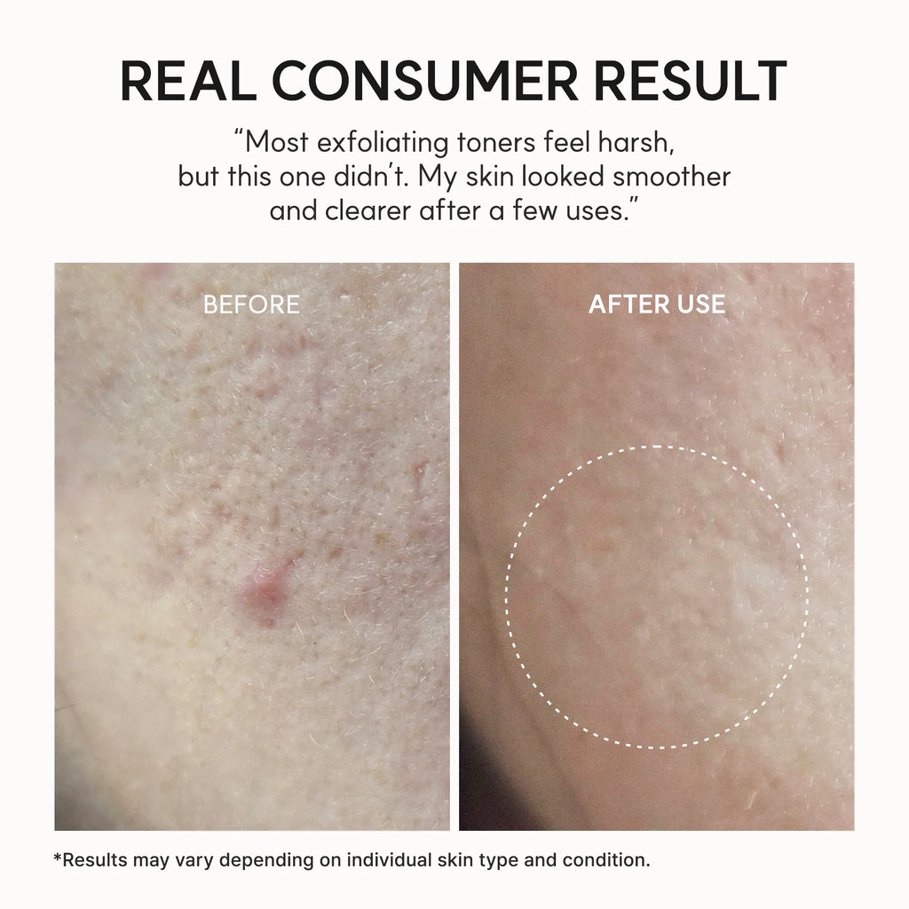 Eraser Shot Glycolic Acid Exfoliator de Arencia