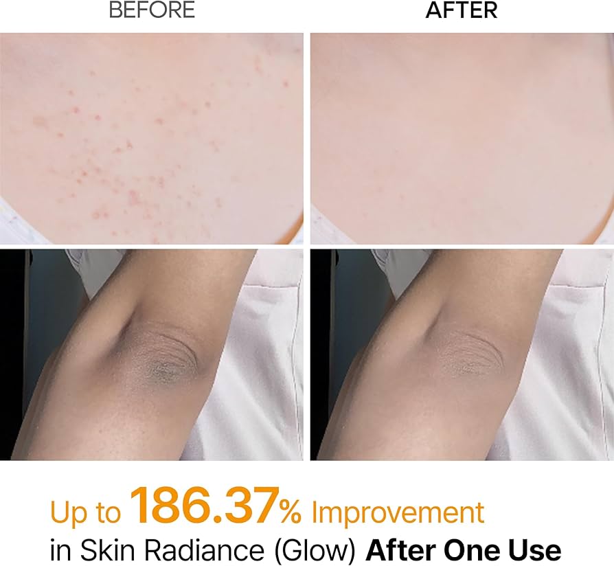 Exfoliante corporal: Peel Shot Kojic Acid Turmeric Body Spray de Dr. Melaxin