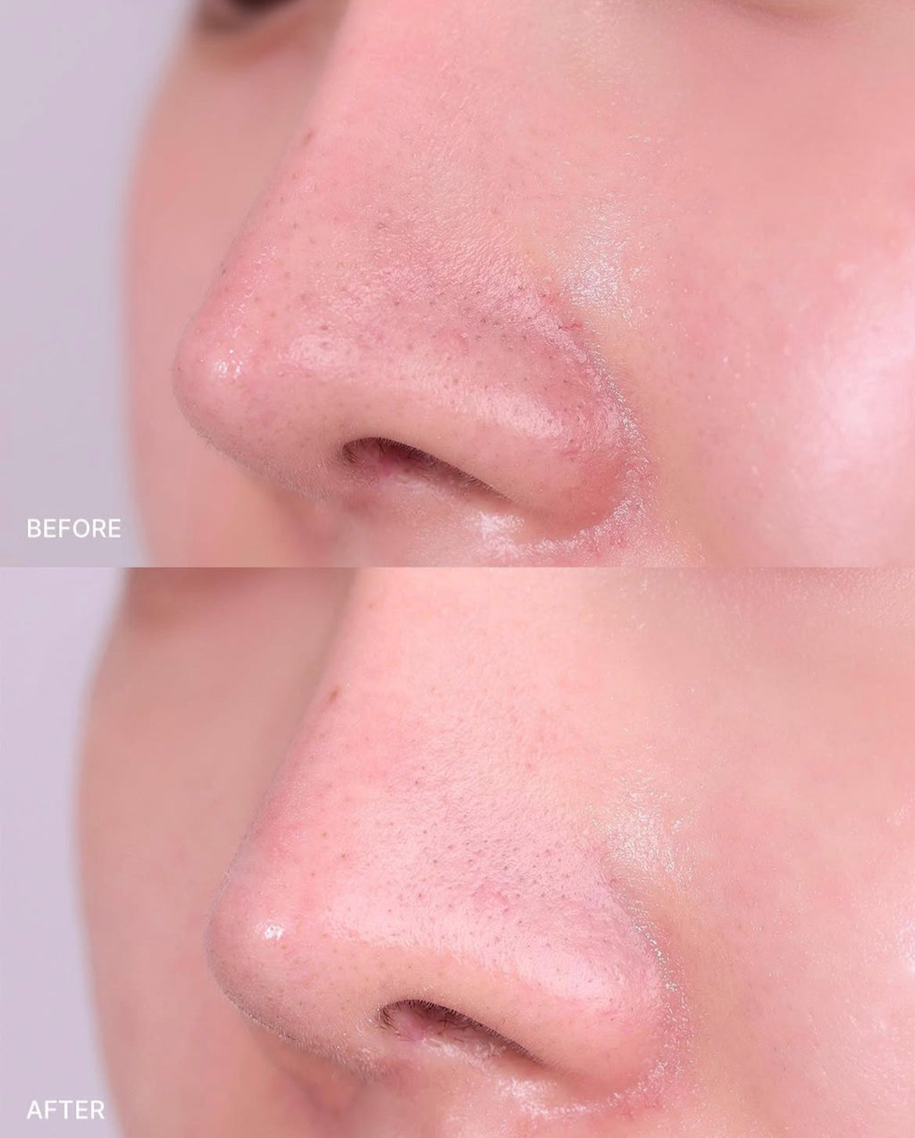 Limpiador + mascarilla: Green Tomato Clay Pack Cleanser de Fully