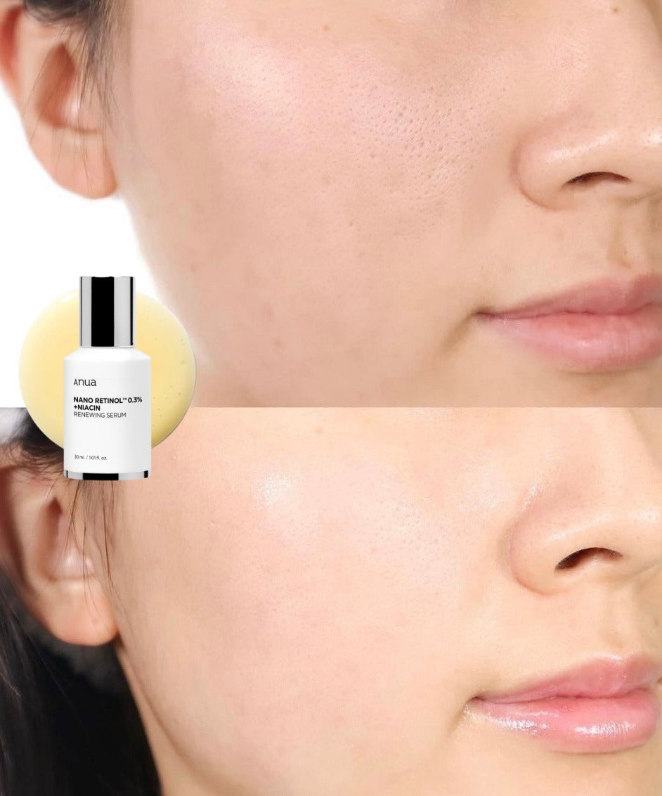 Retinol 0.3% + Niacin Renewing Serum de Anua