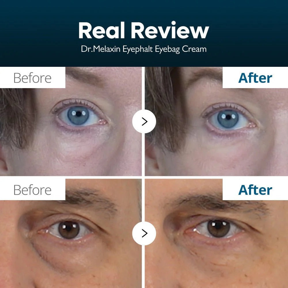 Eyephalt Eyebag Cream de Dr. Melaxin