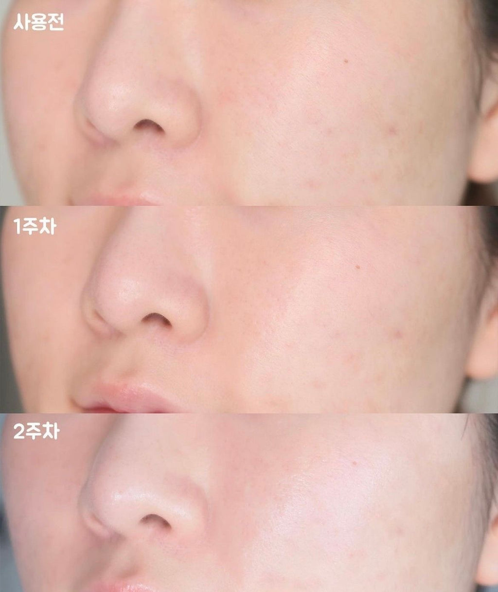 Dark Spot Correcting Glow Serum de Axis-Y