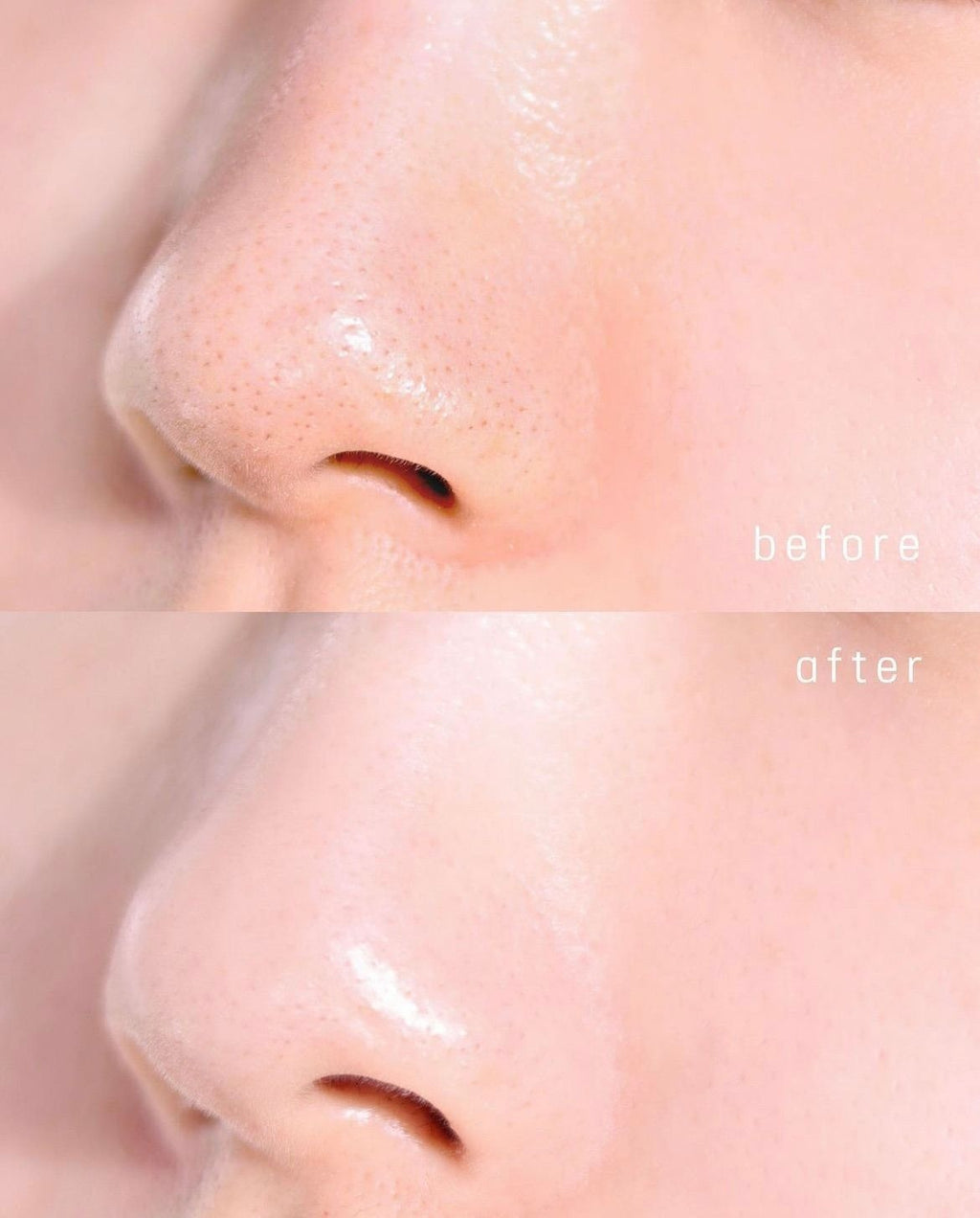 Mascarilla Poremizing Quick Clay Stick Mask de Skin1004