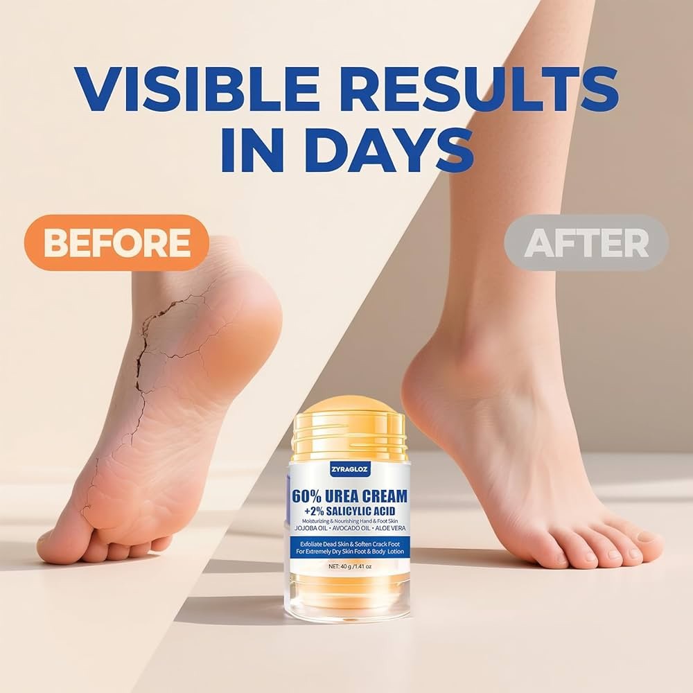 Bálsamo con 60% Urea + 2% Ácido Salicílico para tratar piel rugosa, seca o agrietada