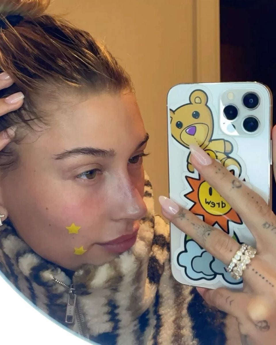 Parches para granitos en forma de estrella de Dr.zitacne