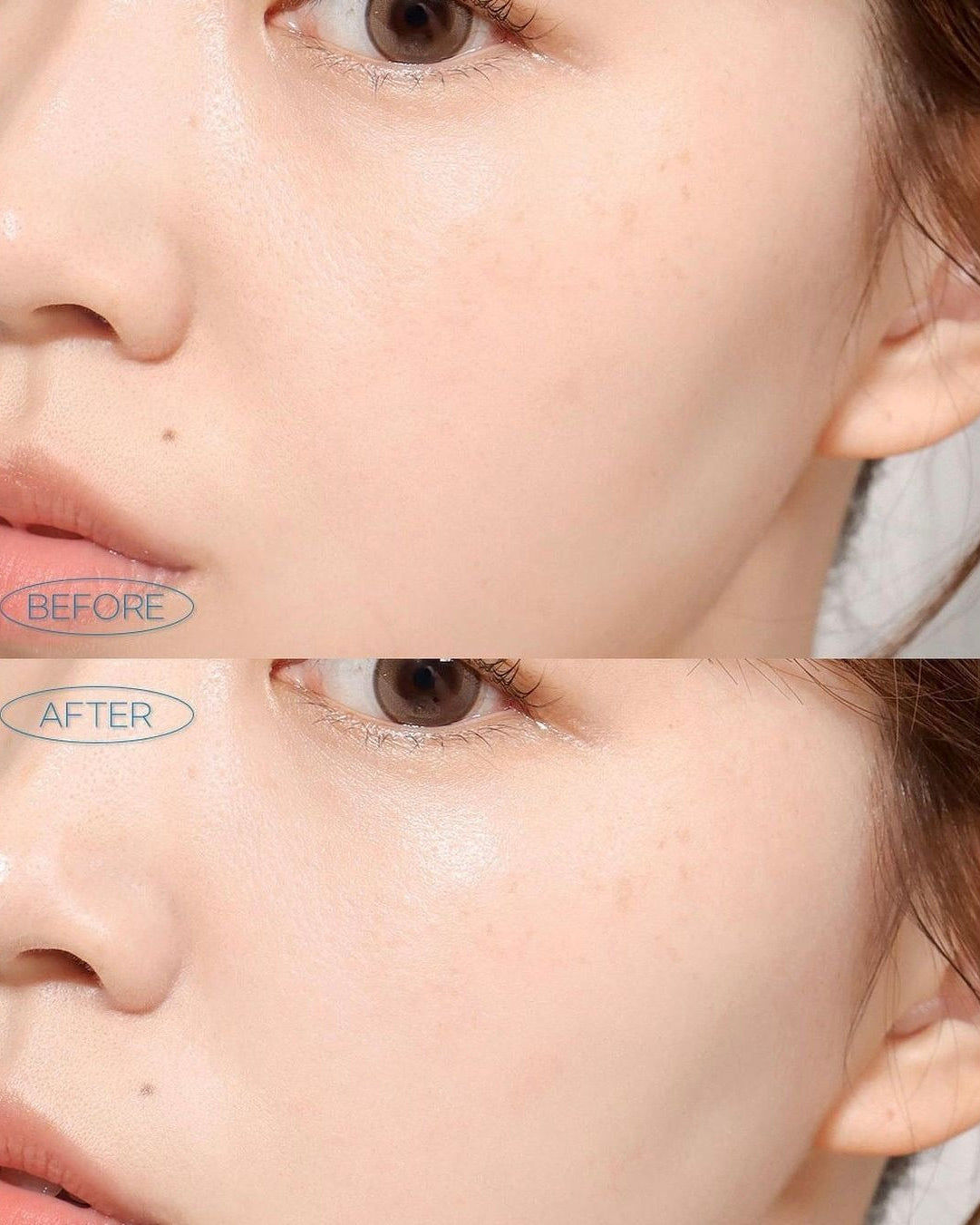 Gel hidratante Madagascar Centella Soothing Gel Cream de Skin1004